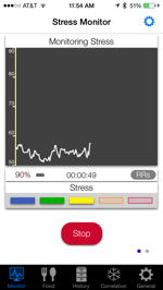 RR Intervals