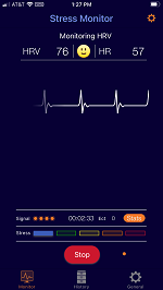 EKG