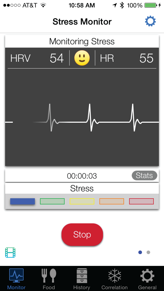 EKG